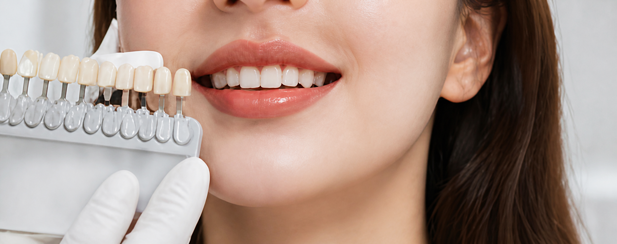 Cosmetic dentistry smile shade selection